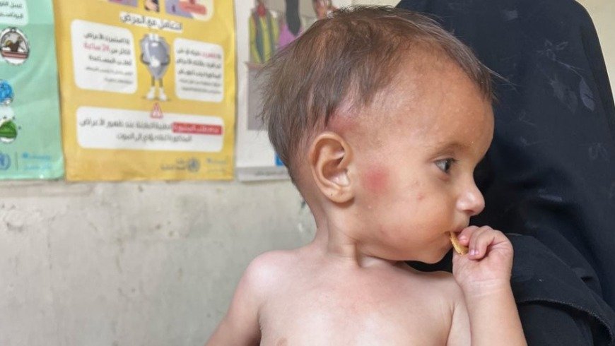 الصحة العالمية: 417 مرفقاً صحياً في سوريا تأثرت بخفض التمويل و366 علّقت خدماتها