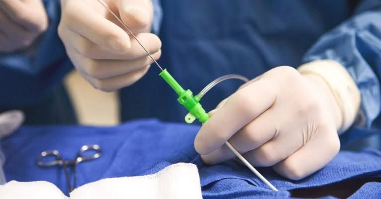 دراسة طبية ترجّح تفوق جراحة القلب المفتوح على القثطرة في استبدال الصمامات الصناعية